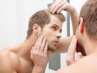 hair loss man mirror